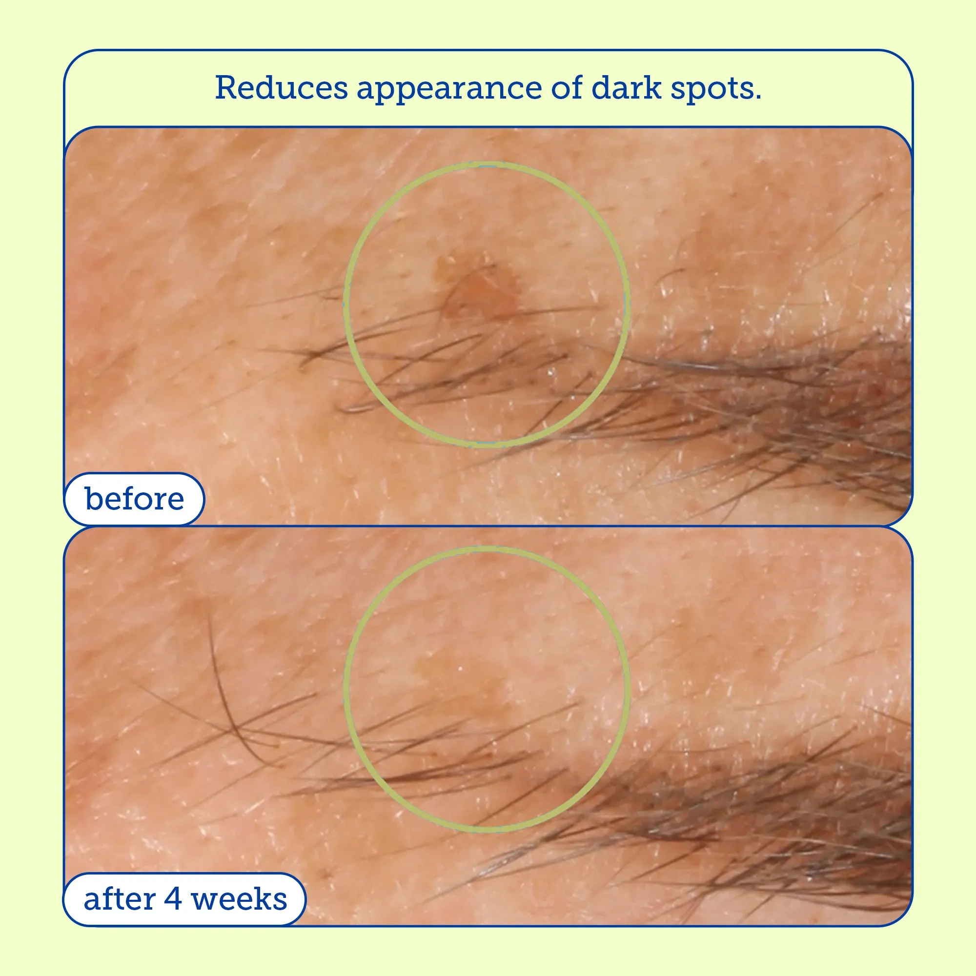 Resurface  Glycol Lactic Brightening Boost